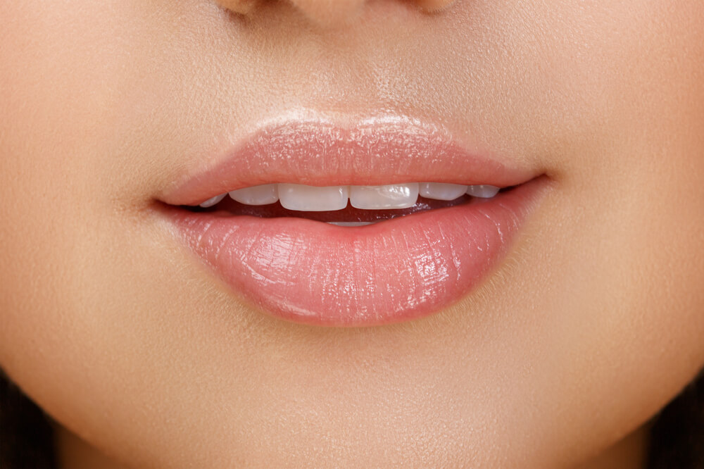 Lip Filler At TreatMyWrinkles Southamtpon Lip Filler At TreatMyWrinkles Southamtpon