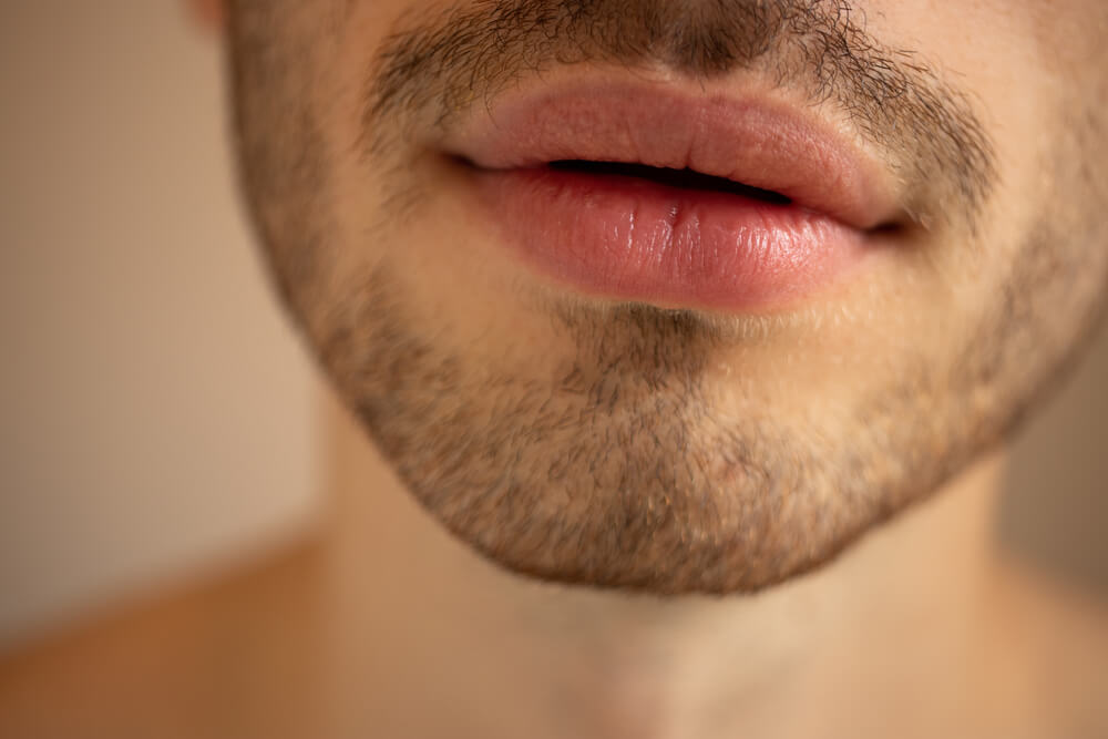 Side Effects From Getting A Lip Filler Side Effects From Getting A Lip Filler