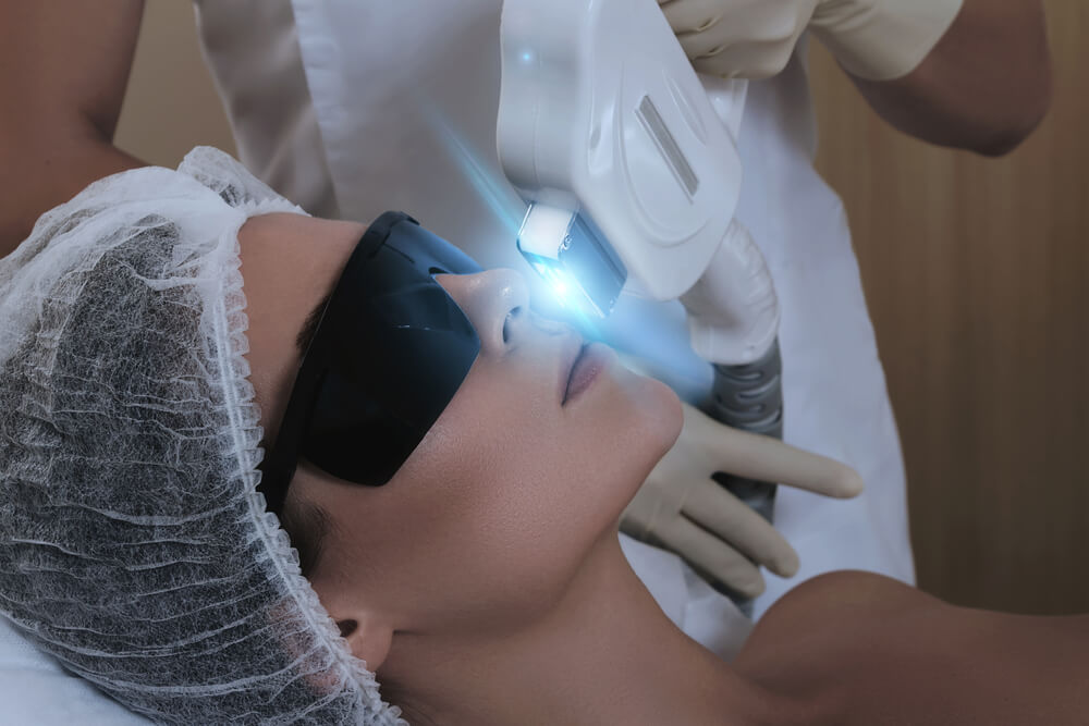 Affordable IPL therapy Southampton Affordable IPL therapy Southampton
