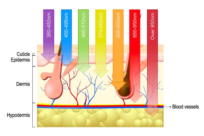 IPL Treatment wavelength IPL Treatment wavelength
